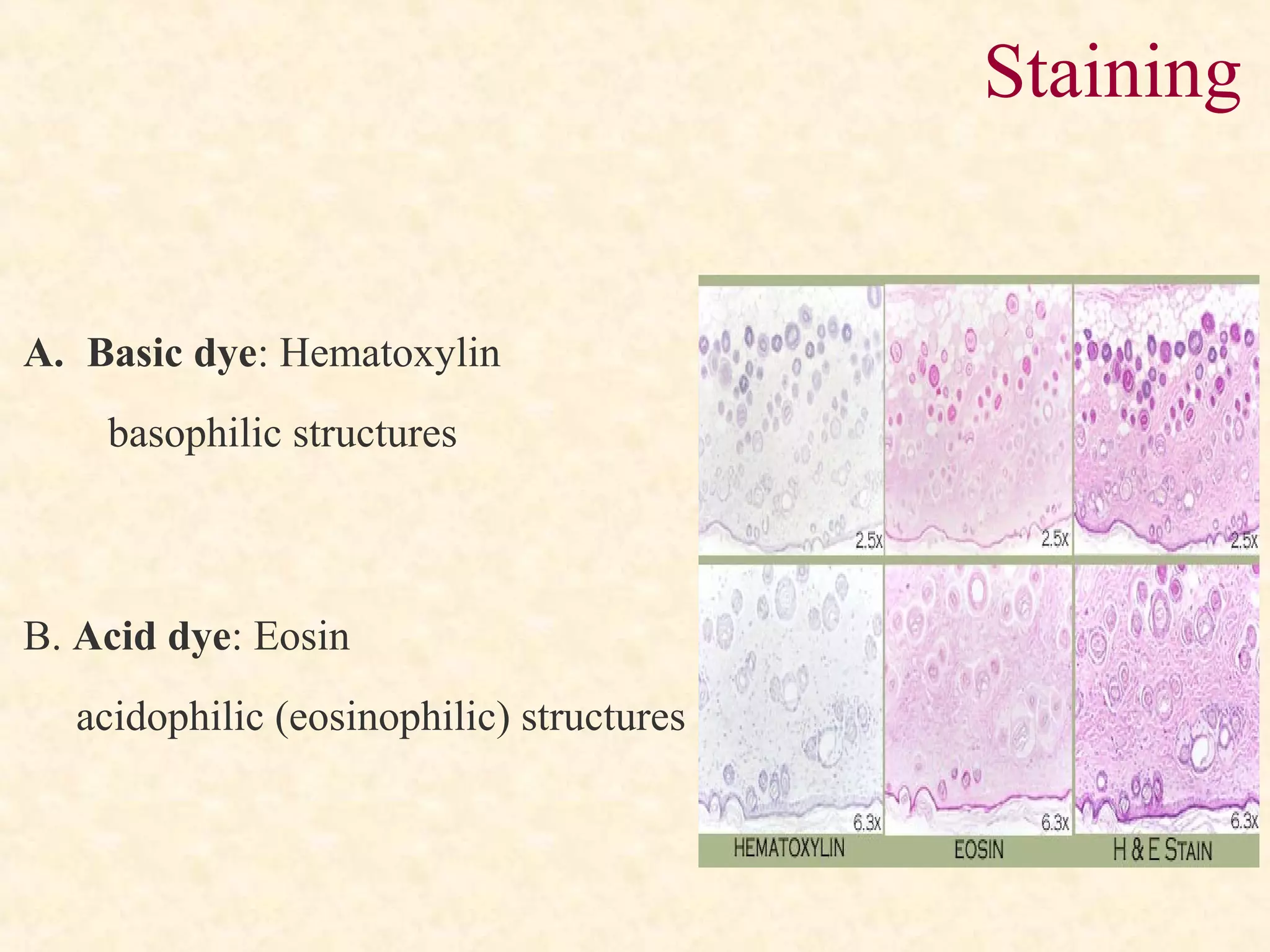 A. Basic dye: Hematoxylin
basophilic structures
B. Acid dye: Eosin
acidophilic (eosinophilic) structures
Staining
 