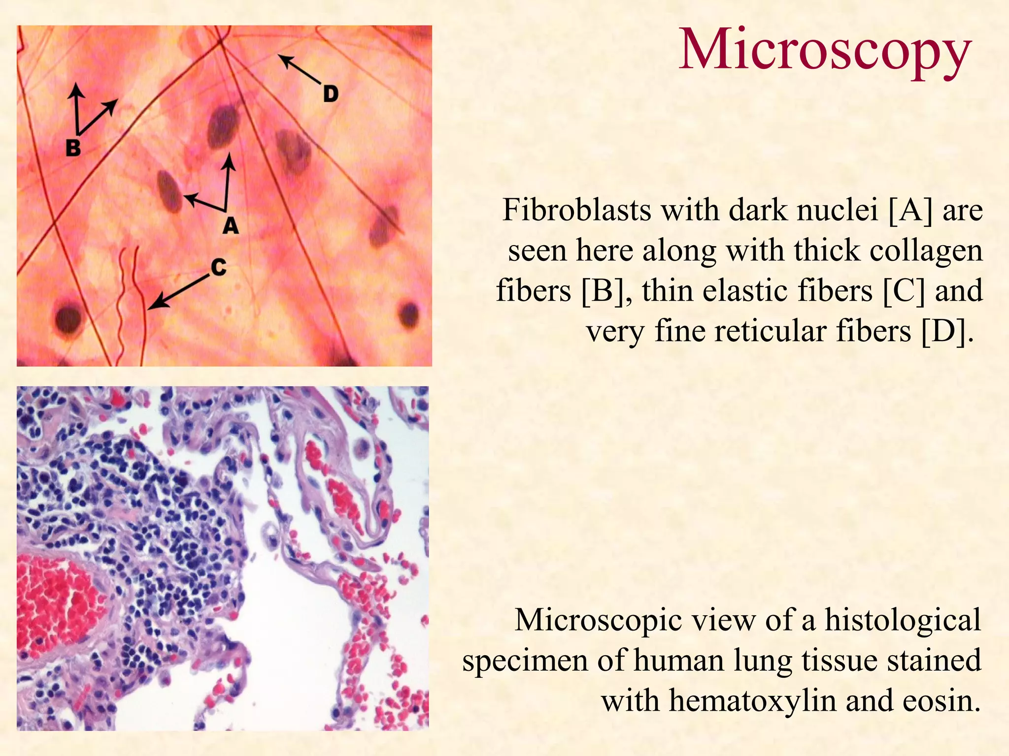 Fibroblasts with dark nuclei [A] are
seen here along with thick collagen
fibers [B], thin elastic fibers [C] and
very fine reticular fibers [D].
Microscopic view of a histological
specimen of human lung tissue stained
with hematoxylin and eosin.
Microscopy
 
