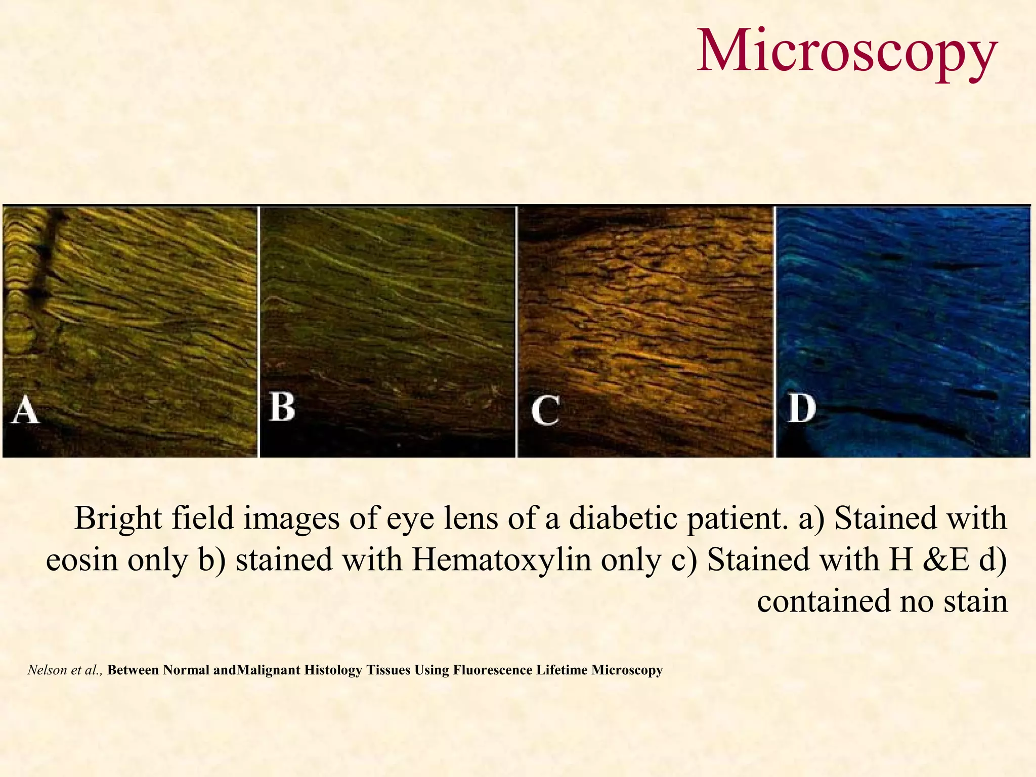 Bright field images of eye lens of a diabetic patient. a) Stained with
eosin only b) stained with Hematoxylin only c) Stained with H &E d)
contained no stain
Nelson et al., Between Normal andMalignant Histology Tissues Using Fluorescence Lifetime Microscopy
Microscopy
 