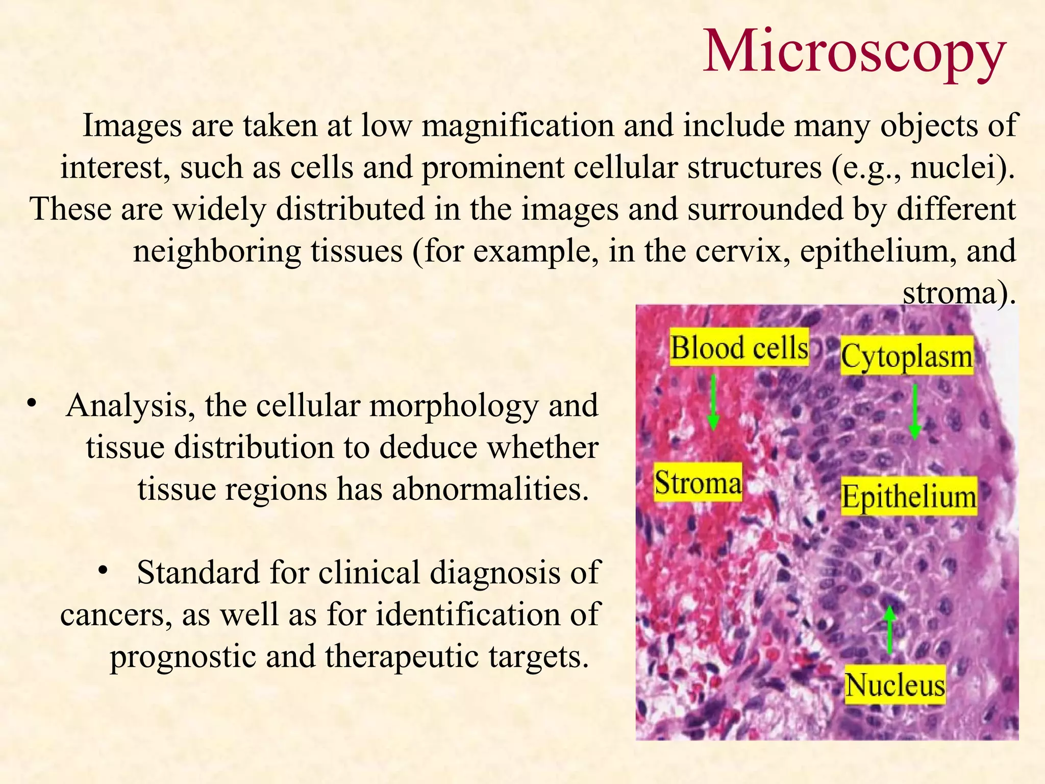 Microscopy
• Analysis, the cellular morphology and
tissue distribution to deduce whether
tissue regions has abnormalities.
• Standard for clinical diagnosis of
cancers, as well as for identification of
prognostic and therapeutic targets.
Images are taken at low magnification and include many objects of
interest, such as cells and prominent cellular structures (e.g., nuclei).
These are widely distributed in the images and surrounded by different
neighboring tissues (for example, in the cervix, epithelium, and
stroma).
 