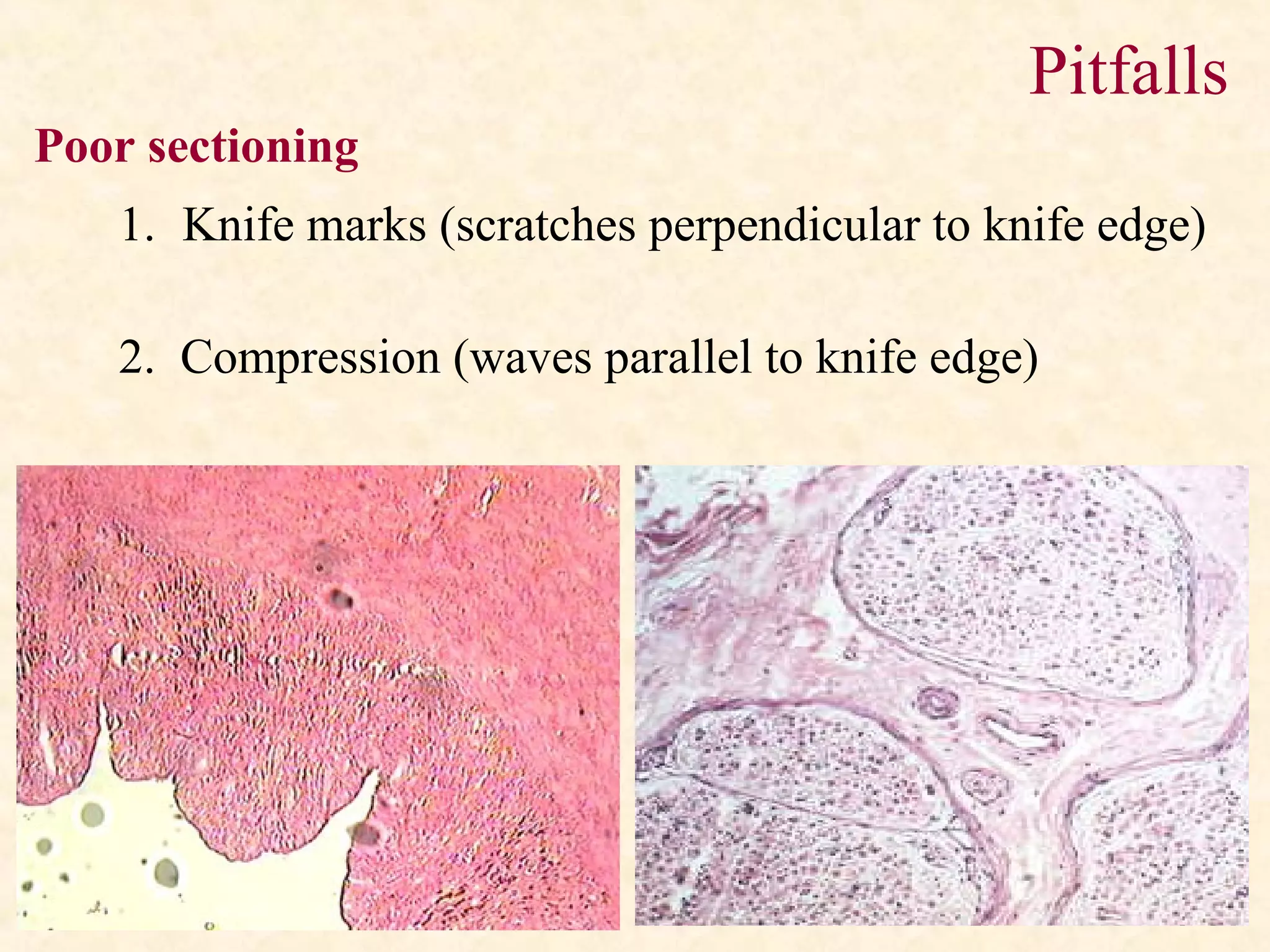 Pitfalls
1. Knife marks (scratches perpendicular to knife edge)
2. Compression (waves parallel to knife edge)
Poor sectioning
 
