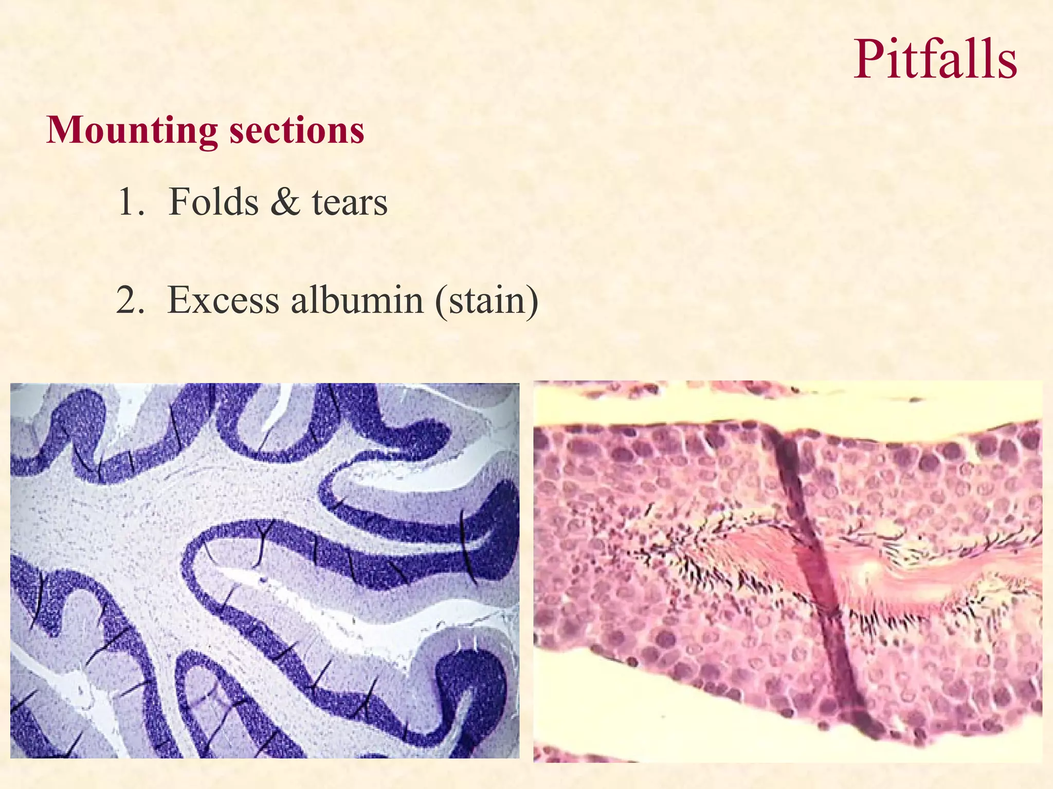 Pitfalls
1. Folds & tears
2. Excess albumin (stain)
Mounting sections
 