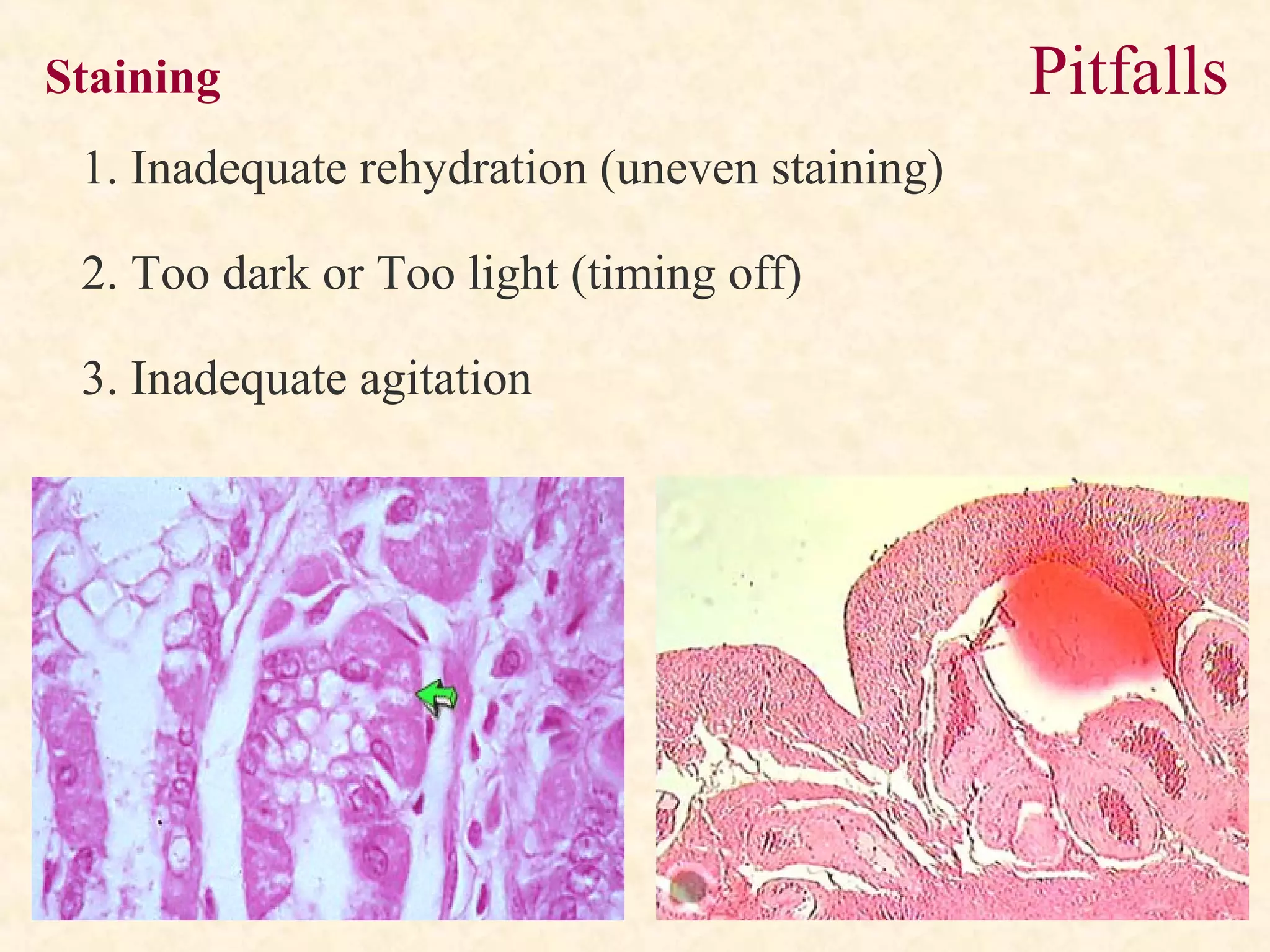 Staining
1. Inadequate rehydration (uneven staining)
2. Too dark or Too light (timing off)
3. Inadequate agitation
Pitfalls
 