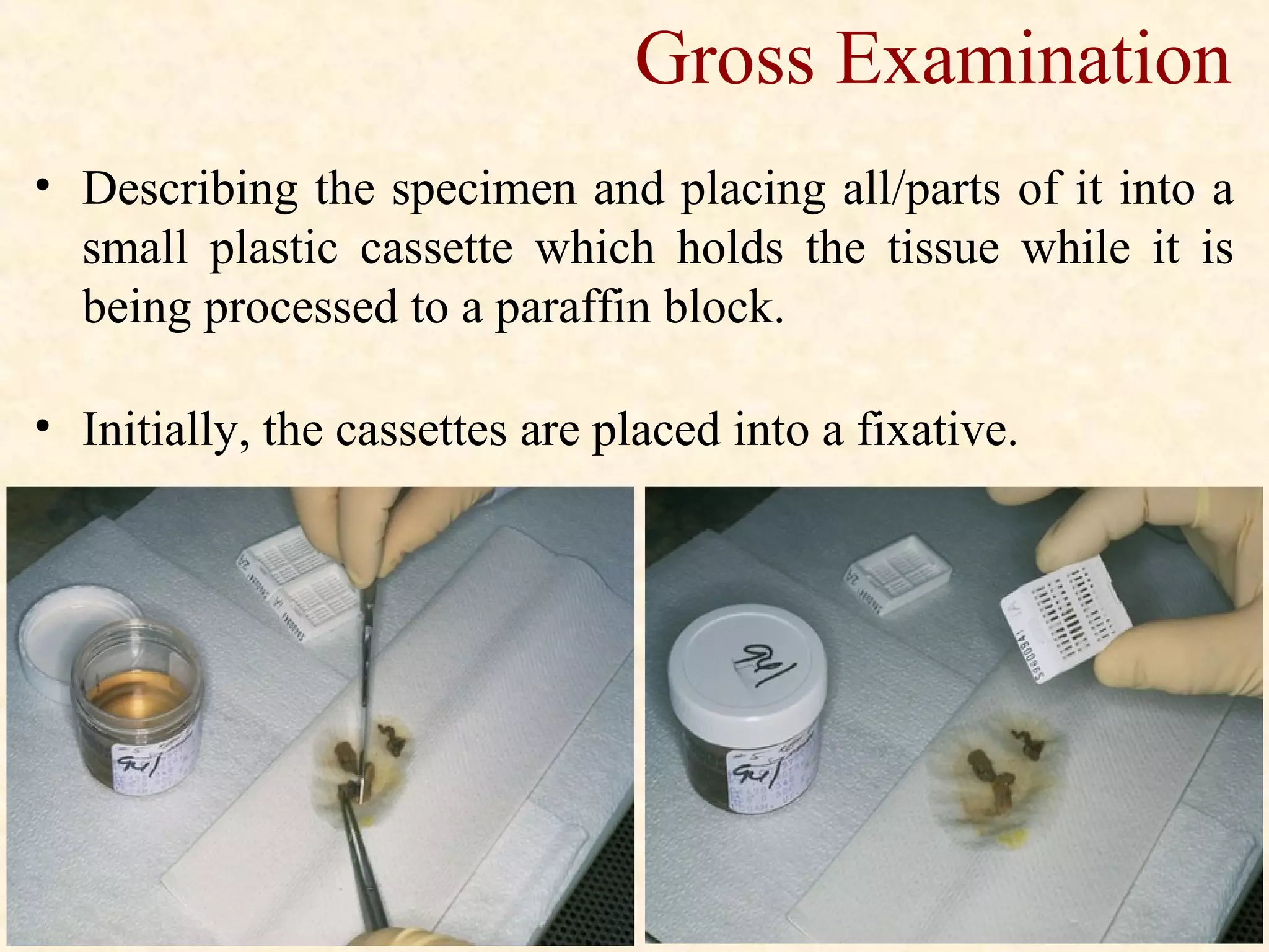 Gross Examination
• Describing the specimen and placing all/parts of it into a
small plastic cassette which holds the tissue while it is
being processed to a paraffin block.
• Initially, the cassettes are placed into a fixative.
 