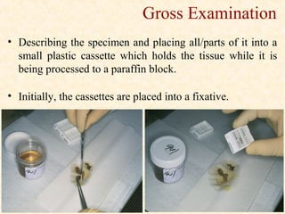 Tissue Processing In Histopathology PPT Tissue Processing In Histopathology PPT