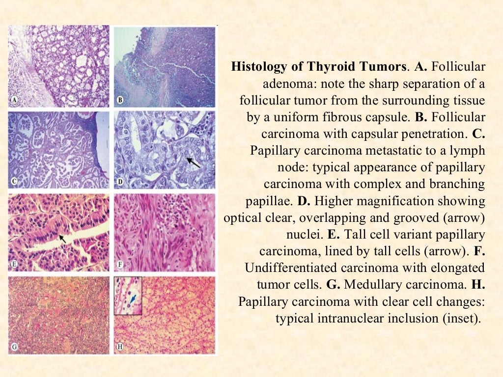 Tissue Processing in Histopathology