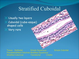 Stratified Cuboidal <ul><li>Usually two layers </li></ul><ul><li>Cuboidal (cube-esque) shaped cells </li></ul><ul><li>Very...