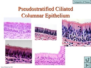 Categories of Tissues
Jenna Hellack Jan 2001
Pseudostratified CiliatedPseudostratified Ciliated
Columnar EpitheliumColumnar Epithelium
 
