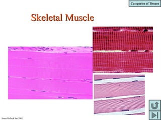 Categories of Tissues
Jenna Hellack Jan 2001
Skeletal MuscleSkeletal Muscle
 