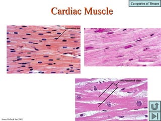 Categories of Tissues
Jenna Hellack Jan 2001
Cardiac MuscleCardiac Muscle
 