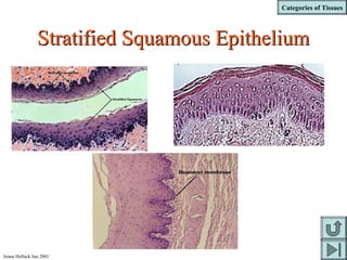 Categories of Tissues
Jenna Hellack Jan 2001
Stratified Squamous EpitheliumStratified Squamous Epithelium
 