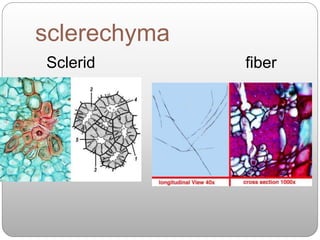 sclerechyma
Sclerid fiber
 