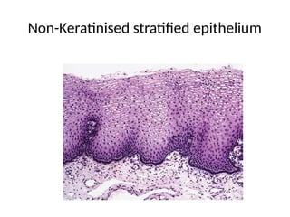 Non-Keratinised stratified epithelium
 
