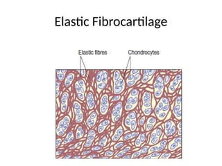 Elastic Fibrocartilage
 