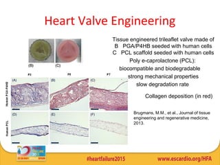 Tissue engineered trileaflet valve made of
B PGA/P4HB seeded with human cells
C PCL scaffold seeded with human cells
Poly e-caprolactone (PCL):
biocompatible and biodegradable
strong mechanical properties
slow degradation rate
Brugmans, M.M., et al., Journal of tissue
engineering and regenerative medicine,
2013.
Collagen deposition (in red)
Heart Valve Engineering
 