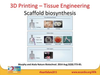 Murphy and Atala Nature Biotechnol. 2014 Aug;32(8):773-85.
3D Printing – Tissue Engineering
Scaffold biosynthesis
 