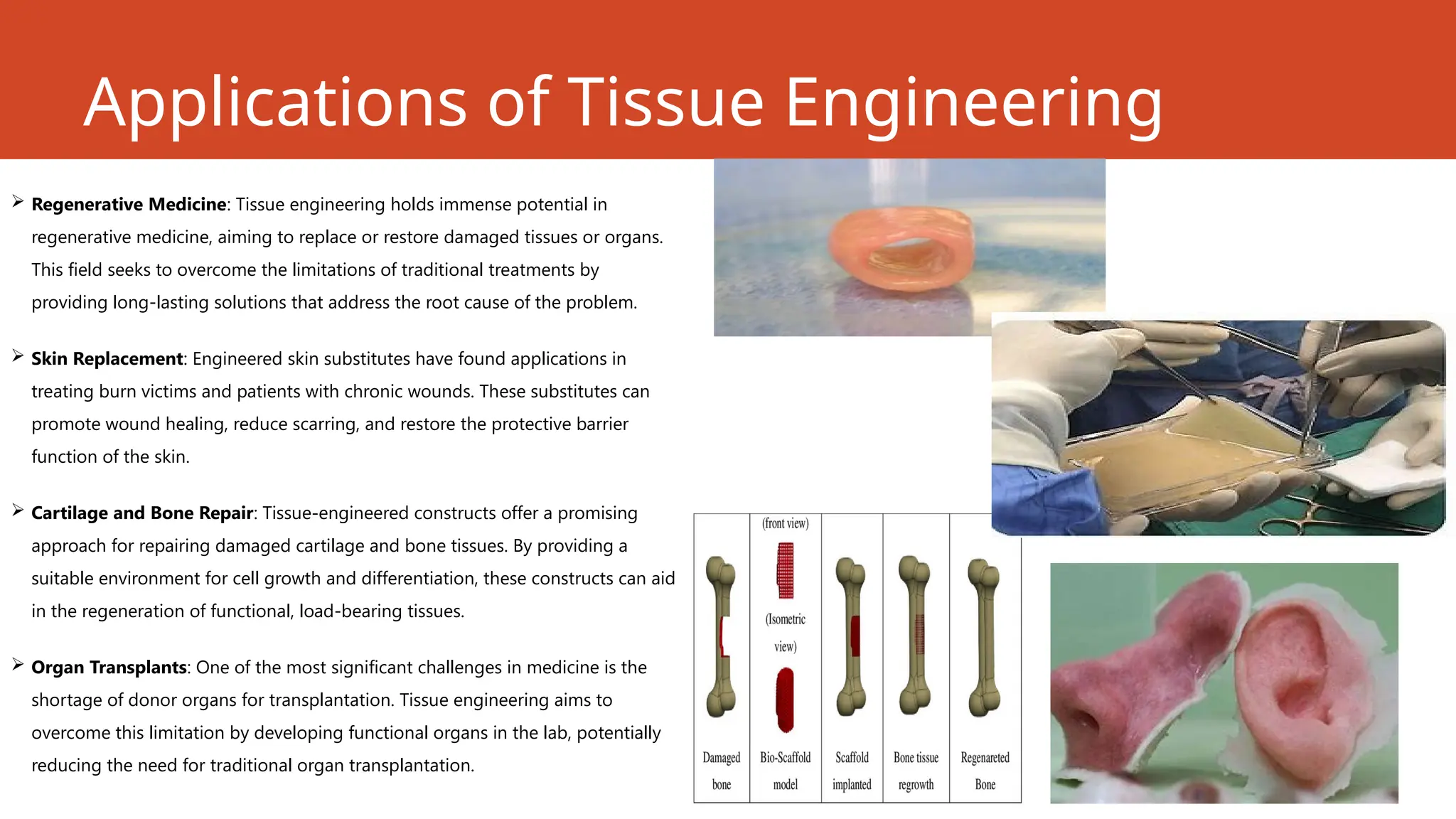Applications of Tissue Engineering
 Regenerative Medicine: Tissue engineering holds immense potential in
regenerative medicine, aiming to replace or restore damaged tissues or organs.
This field seeks to overcome the limitations of traditional treatments by
providing long-lasting solutions that address the root cause of the problem.
 Skin Replacement: Engineered skin substitutes have found applications in
treating burn victims and patients with chronic wounds. These substitutes can
promote wound healing, reduce scarring, and restore the protective barrier
function of the skin.
 Cartilage and Bone Repair: Tissue-engineered constructs offer a promising
approach for repairing damaged cartilage and bone tissues. By providing a
suitable environment for cell growth and differentiation, these constructs can aid
in the regeneration of functional, load-bearing tissues.
 Organ Transplants: One of the most significant challenges in medicine is the
shortage of donor organs for transplantation. Tissue engineering aims to
overcome this limitation by developing functional organs in the lab, potentially
reducing the need for traditional organ transplantation.
 