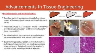 Advancements In Tissue Engineering
2.Decellularization and Recellularization:
 Decellularization involves removing cells from donor
organs while preserving the organ's extracellular matrix
(ECM).
 The decellularized ECM serves as a natural scaffold that
provides structural support and biochemical cues for
tissue regeneration.
 Recellularization is the process of repopulating the
decellularized scaffold with patient-specific cells.
 By combining decellularization and recellularization
techniques, tissue engineers can create personalized
organ constructs that closely match the recipient's
immune profile, reducing the risk of rejection.
 