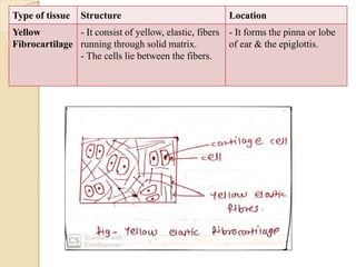 Type of tissue Structure Location
Yellow
Fibrocartilage
- It consist of yellow, elastic, fibers
running through solid matrix.
- The cells lie between the fibers.
- It forms the pinna or lobe
of ear & the epiglottis.
 
