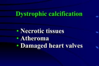 Necrotic tissues Atheroma Damaged heart valves Dystrophic calcification 