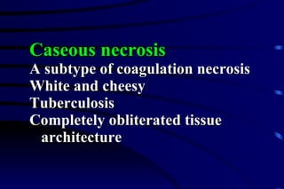 Caseous necrosis A subtype of coagulation necrosis White and cheesy Tuberculosis Completely obliterated tissue  architecture 