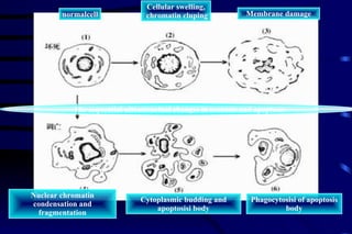 normalcell Cellular swelling, chromatin cluping Membrane damage Nuclear chromatin condensation and fragmentation Cytoplasmic budding and apoptosisi body Phagocytosisi of apoptosis body The sequential ultrastructual changes in necrosis and apoptosis 