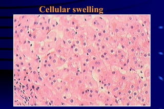 Cellular swelling 