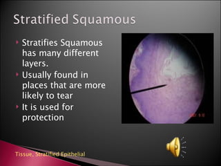 Stratifies Squamous has many different  layers. Usually found in places that are more likely to tear It is used for protection Tissue,  Stratified Epithelial    