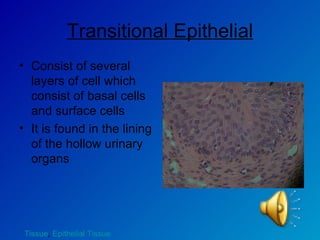 Transitional Epithelial Consist of several layers of cell which consist of basal cells and surface cells It is found in the lining of the hollow urinary organs  Tissue ,  Epithelial Tissue 