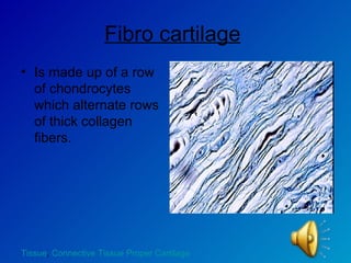 Fibro cartilage   Is made up of a row of chondrocytes which alternate rows of thick collagen fibers. Tissue ,  Connective Tissue Proper Cartilage 
