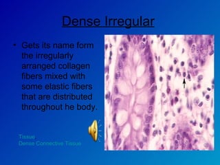 Dense Irregular   Gets its name form the irregularly arranged collagen fibers mixed with some elastic fibers that are distributed throughout he body.  Tissue ,  Dense Connective Tissue 