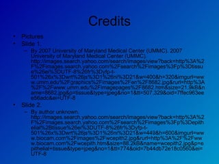 Credits Pictures Slide 1. By 2007 University of Maryland Medical Center (UMMC). 2007 University of Maryland Medical Center (UMMC). http://images.search.yahoo.com/search/images/view?back=http%3A%2F%2Fimages.search.yahoo.com%2Fsearch%2Fimages%3Fp%3Dtissue%26ei%3DUTF-8%26fr%3Dyfp-t-501%26x%3Dwrt%26js%3D1%26ni%3D21&w=400&h=320&imgurl=www.umm.edu%2Fgraphics%2Fimages%2Fen%2F8682.jpg&rurl=http%3A%2F%2Fwww.umm.edu%2Fimagepages%2F8682.htm&size=21.9kB&name=8682.jpg&p=tissue&type=jpeg&no=1&tt=507,329&oid=7ffec963eee56adc&ei=UTF-8 Slide 2. By author unknown. http://images.search.yahoo.com/search/images/view?back=http%3A%2F%2Fimages.search.yahoo.com%2Fsearch%2Fimages%3Fp%3Depithelial%2Btissue%26ei%3DUTF-8%26fr%3Dyfp-t-501%26x%3Dwrt%26js%3D1%26ni%3D21&w=449&h=600&imgurl=www.biocam.com%2Fimages%2Fwcepith2.jpg&rurl=http%3A%2F%2Fwww.biocam.com%2Fwcepith.htm&size=88.2kB&name=wcepith2.jpg&p=epithelial+tissue&type=jpeg&no=1&tt=774&oid=7b44db72e18c0560&ei=UTF-8  