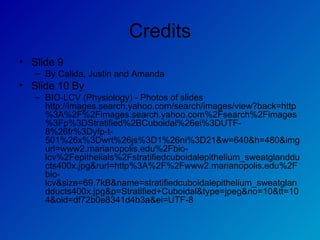 Credits Slide 9 By Calida, Justin and Amanda Slide 10 By  BIO-LCV (Physiology) - Photos of slides http://images.search.yahoo.com/search/images/view?back=http%3A%2F%2Fimages.search.yahoo.com%2Fsearch%2Fimages%3Fp%3DStratified%2BCuboidal%26ei%3DUTF-8%26fr%3Dyfp-t-501%26x%3Dwrt%26js%3D1%26ni%3D21&w=640&h=480&imgurl=www2.marianopolis.edu%2Fbio-lcv%2Fepithelials%2Fstratifiedcuboidalepithelium_sweatglandducts400x.jpg&rurl=http%3A%2F%2Fwww2.marianopolis.edu%2Fbio-lcv&size=69.7kB&name=stratifiedcuboidalepithelium_sweatglandducts400x.jpg&p=Stratified+Cuboidal&type=jpeg&no=10&tt=104&oid=df72b0e8341d4b3a&ei=UTF-8 