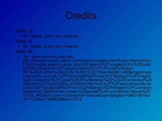 Credits Slide 18  By  Calida, Justin and Amanda Slide 19  By  Calida, Justin and Amanda Slide 20 By  acpcommunity.acp.edu http://images.search.yahoo.com/search/images/view?back=http%3A%2F%2Fimages.search.yahoo.com%2Fsearch%2Fimages%3Fp%3DLoose%2BConnective%2BTissue%26ei%3DUTF-8%26fr%3Dyfp-t-501%26x%3Dwrt%26js%3D1%26ni%3D21&w=640&h=480&imgurl=acpcommunity.acp.edu%2FFacultystaff%2Fmoon%2FBiology2%2FImages%2FConnective%2FLoose%2520%28areolar%29%2520connective%2520tissue%2C%2520200x.JPG&rurl=http%3A%2F%2Facpcommunity.acp.edu%2FFacultystaff%2Fmoon%2FBiology2%2FImages%2FConnective&size=42.3kB&name=Loose+%28areolar%29+connective+tissue%2C+200x.JPG&p=Loose+Connective+Tissue&type=jpeg&no=5&tt=281&oid=1124d5ec7569f638&ei=UTF-8 