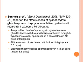  Sonmez et al . ( Eur J Ophthalmol. 2008;18(4):529-
31 ) reported the effectiveness of cyanoacrylate
glue blepharorrhaphy in immobilized patients with
recalcitrant exposure keratopathy.
 Temporal two thirds of upper eyelid eyelashes were
glued to lower eyelid skin with tissue adhesive n-butyl-2-
cyanoacrylate after application of a contact lens in 12
eyes of 9 patients.
 All the corneal ulcers healed within 4 to 11 days (mean:
5.5 days).
 Blepharorrhaphy opened spontaneously in 4 to 21 days
(mean: 8.6 days)
 