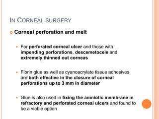 IN CORNEAL SURGERY
 Corneal perforation and melt
 For perforated corneal ulcer and those with
impending perforations, descemetocele and
extremely thinned out corneas
 Fibrin glue as well as cyanoacrylate tissue adhesives
are both effective in the closure of corneal
perforations up to 3 mm in diameter
 Glue is also used in fixing the amniotic membrane in
refractory and perforated corneal ulcers and found to
be a viable option
 