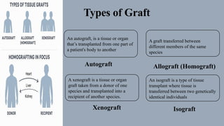 Isograft Examples Tissue and Homografting.....presentation | PPTX