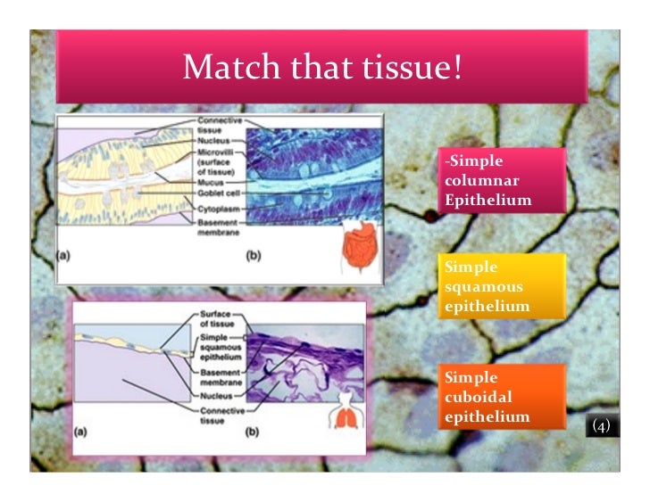 Tissue artifact