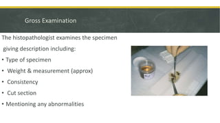 Gross Examination
The histopathologist examines the specimen
giving description including:
• Type of specimen
• Weight & measurement (approx)
• Consistency
• Cut section
• Mentioning any abnormalities
 