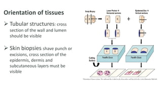 Orientation of tissues
 Tubular structures: cross
section of the wall and lumen
should be visible
 Skin biopsies: shave punch or
excisions, cross section of the
epidermis, dermis and
subcutaneous layers must be
visible
 
