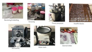 Receiving & labelling
Grossing
Tissue processor Paraffin blocks
Microtomy
Water bath
Stained slides
 