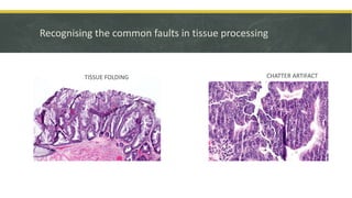 Recognising the common faults in tissue processing
TISSUE FOLDING CHATTER ARTIFACT
 