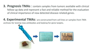 3. Prognosis TMAs : contain samples from tumors available with clinical
follow-up data and represent a fast and reliable method for the evaluation
of clinical importance of new detected disease-related genes.
4. Experimental TMAs: are constructed from cell lines or samples from TMA
archives for testing new antibodies and looking for gene targets.
 