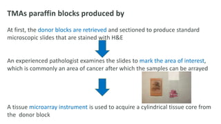 TMAs paraffin blocks produced by
At first, the donor blocks are retrieved and sectioned to produce standard
microscopic slides that are stained with H&E
An experienced pathologist examines the slides to mark the area of interest,
which is commonly an area of cancer after which the samples can be arrayed
A tissue microarray instrument is used to acquire a cylindrical tissue core from
the donor block
 