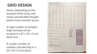 Varies, depending on the
purpose of the array, and
needs considerable thought
before tissue transfer occurs
A large number of samples
(high density) can be
arrayed in a 37 × 24 × 5 mm
block and
A smaller number of
samples (low density) in a
24 × 24 × 5 mm block.
GRID DESIGN
 