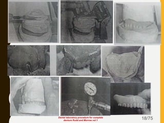 18/75Dental laboratory procedure for complete
denture Rudd and Morrow vol 1
 