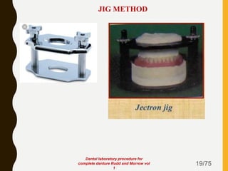 19/75
JIG METHOD
Dental laboratory procedure for
complete denture Rudd and Morrow vol
1
 