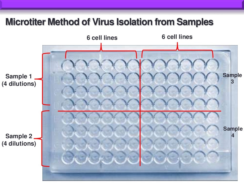 Tissue culture and virology (cpe, plaque assay)