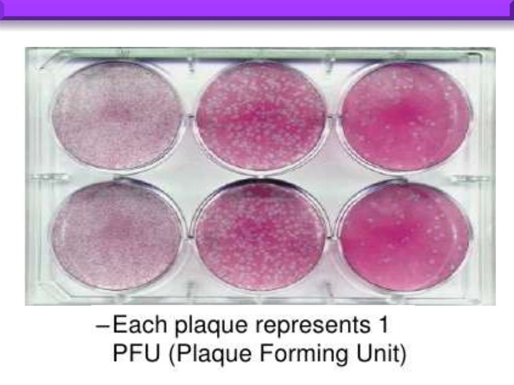 Tissue culture and virology (cpe, plaque assay)