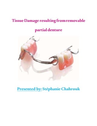 TissueDamage resultingfromremovable
partialdenture
Presented by:Stéphanie Chahrouk
 